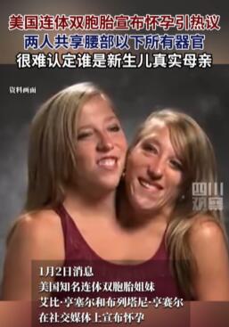 美国双头姐妹宣布怀孕引热议